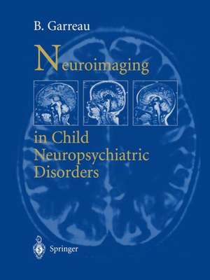 Neuroimaging in child neuropsychiatric disorders de B. Garreau