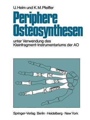 Periphere Osteosynthesen: Unter Verwendung des Kleinfragment-Instrumentariums der AO de H.C. Meuli