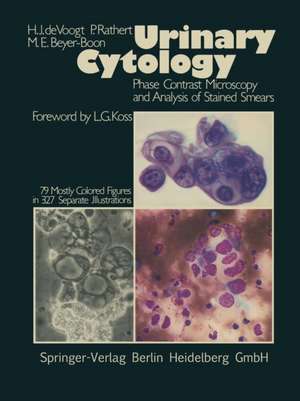 Urinary Cytology: Phase Contrast Microscopy and Analysis of Stained Smears de H. J. de Voogt