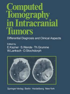 Computed Tomography in Intracranial Tumors: Differential Diagnosis and Clinical Aspects de G.B. Bradac