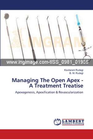 Managing The Open Apex - A Treatment Treatise de Kavitarani Rudagi