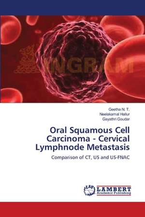 Oral Squamous Cell Carcinoma - Cervical Lymphnode Metastasis de Geetha N. T.