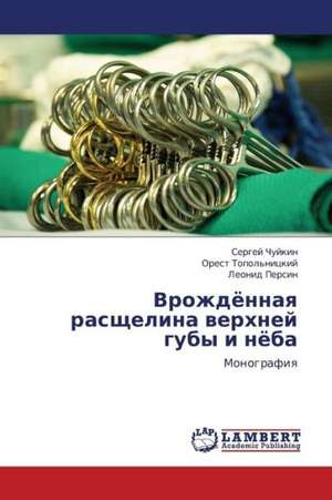 Vrozhdyennaya rasshchelina verkhney guby i nyeba de Chuykin Sergey