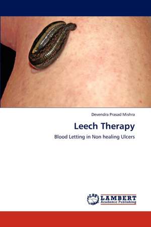 Leech Therapy de Mishra Devendra Prasad