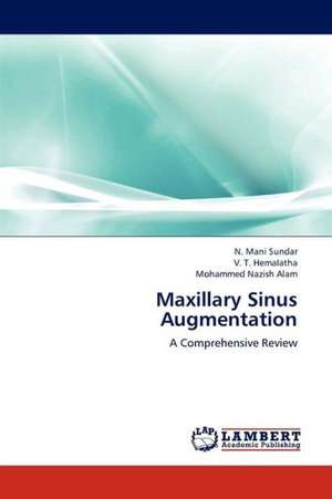 Maxillary Sinus Augmentation de Sundar N. Mani