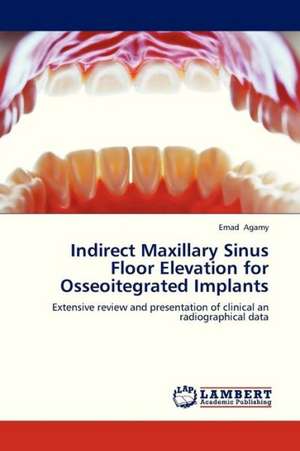 Indirect Maxillary Sinus Floor Elevation for Osseoitegrated Implants de Agamy Emad