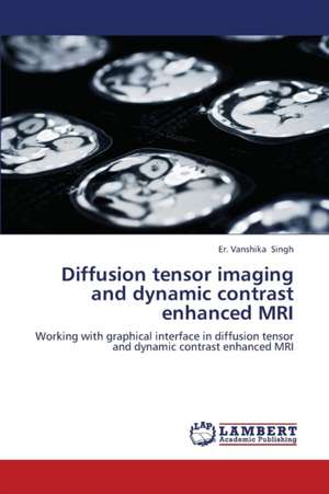 Diffusion tensor imaging and dynamic contrast enhanced MRI de Singh Er. Vanshika