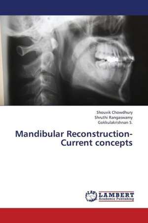 Mandibular Reconstruction- Current concepts de Chowdhury Shouvik