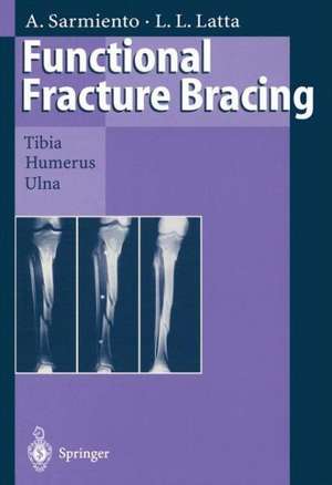 Functional Fracture Bracing: Tibia, Humerus, and Ulna de Augusto Sarmiento