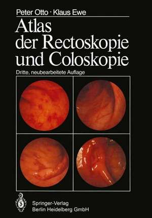 Atlas der Rectoskopie und Coloskopie de Potto