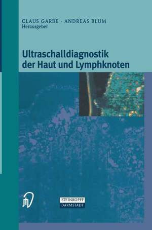 Ultraschalldiagnostik der Haut und Lymphknoten de Klaus Garbe