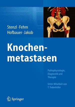 Knochenmetastasen: Pathophysiologie, Diagnostik und Therapie - Unter Mitarbeit von T. Todenhöfer de Arnulf Stenzl