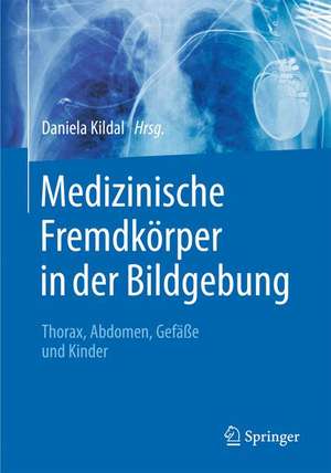 Medizinische Fremdkörper in der Bildgebung: Thorax, Abdomen, Gefäße und Kinder de Daniela Kildal