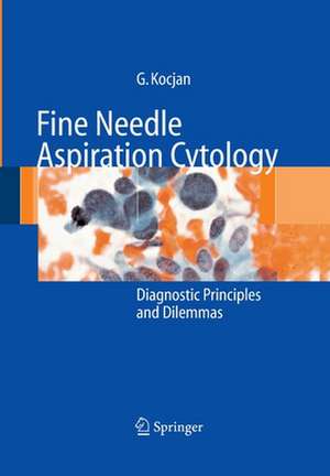 Fine Needle Aspiration Cytology: Diagnostic Principles and Dilemmas de Gabrijela Kocjan