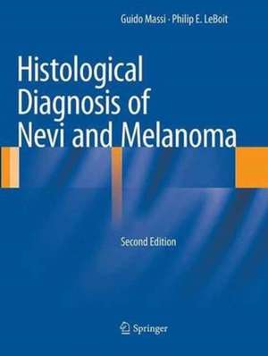 Histological Diagnosis of Nevi and Melanoma de Guido Massi