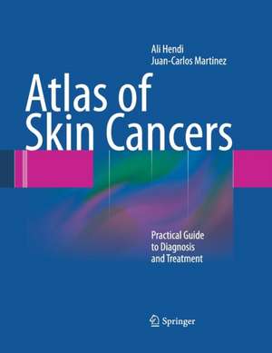 Atlas of Skin Cancers: Practical Guide to Diagnosis and Treatment de Ali Hendi