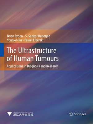 The Ultrastructure of Human Tumours: Applications in Diagnosis and Research de Brian Eyden