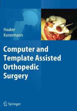 Computer and Template Assisted Orthopedic Surgery de Rolf Haaker