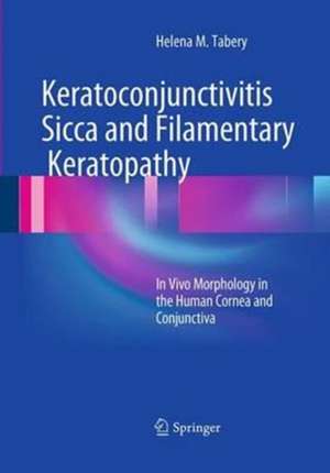 Keratoconjunctivitis Sicca and Filamentary Keratopathy: In Vivo Morphology in the Human Cornea and Conjunctiva de Helena M. Tabery