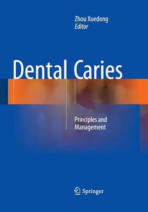 Dental Caries: Principles and Management de Zhou Xuedong