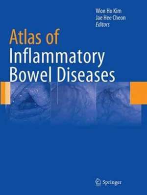 Atlas of Inflammatory Bowel Diseases de Won Ho Kim