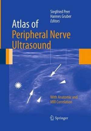 Atlas of Peripheral Nerve Ultrasound: With Anatomic and MRI Correlation de Siegfried Peer