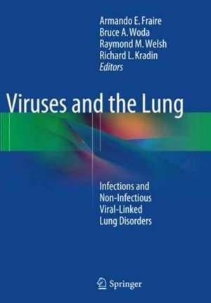 Viruses and the Lung: Infections and Non-Infectious Viral-Linked Lung Disorders de Armando E. Fraire