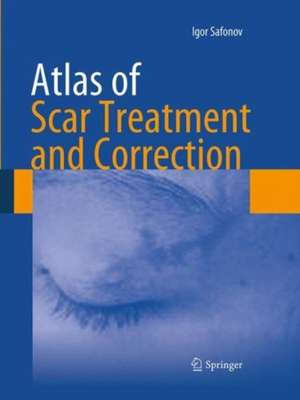 Atlas of Scar Treatment and Correction de Igor Safonov