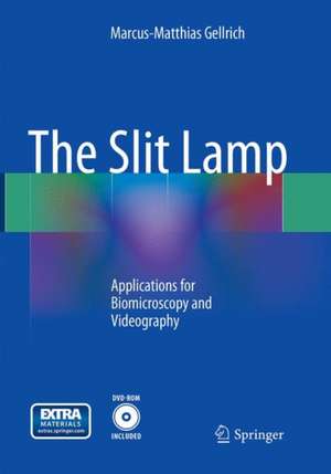 The Slit Lamp: Applications for Biomicroscopy and Videography de Marcus-Matthias Gellrich