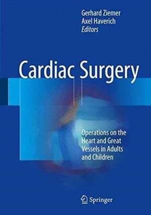 Cardiac Surgery: Operations on the Heart and Great Vessels in Adults and Children de Gerhard Ziemer