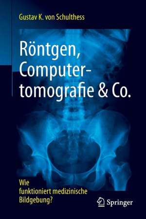 Röntgen, Computertomografie & Co.: Wie funktioniert medizinische Bildgebung? de Gustav K. von Schulthess