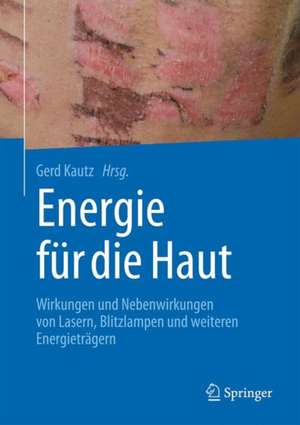 Energie für die Haut: Wirkungen und Nebenwirkungen von Lasern, Blitzlampen und weiteren Energieträgern de Gerd Kautz