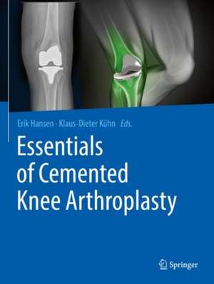 Essentials of Cemented Knee Arthroplasty de Erik Hansen