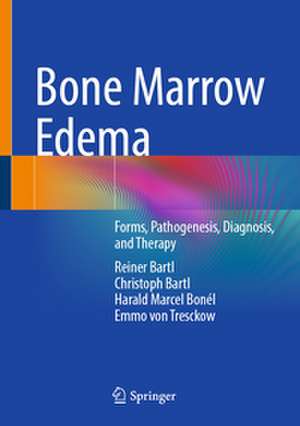 Bone Marrow Edema de Reiner Bartl