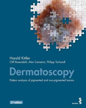 Dermatoscopy de Harald Kittler