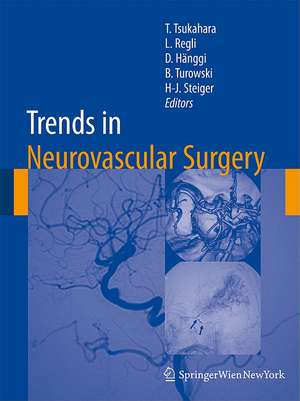 Trends in Neurovascular Surgery de Tetsuya Tsukahara