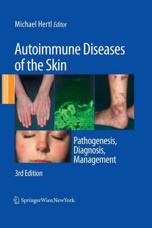 Autoimmune Diseases of the Skin: Pathogenesis, Diagnosis, Management de Michael Hertl