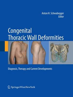 Congenital Thoracic Wall Deformities: Diagnosis, Therapy and Current Developments de Anton H. Schwabegger