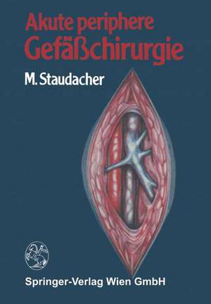 Akute periphere Gefäßchirurgie de M. Staudacher