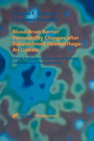 Blood-Brain Barrier Permeability Changes after Subarachnoid Haemorrhage: An Update: Clinical Implications, Experimental Findings, Challenges and Future Directions de Antonio F. Germano