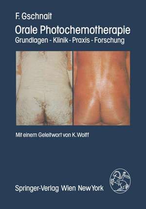 Orale Photochemotherapie: Grundlagen — Klinik — Praxis — Forschung de F. Gschnait