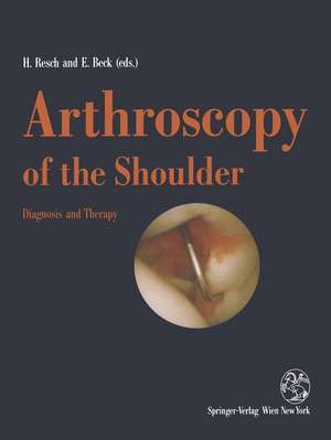 Arthroscopy of the Shoulder: Diagnosis and Therapy de Herbert Resch