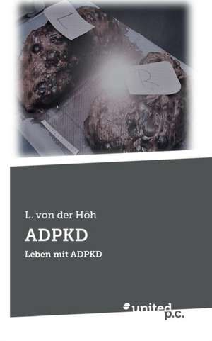 ADPKD de L. von der Höh