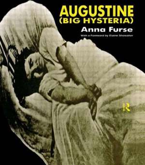 Augustine (Big Hysteria) de Anna Furse