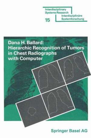 Hierarchic Recognition of Tumors in Chest Radiographs with Computer de BALLARD