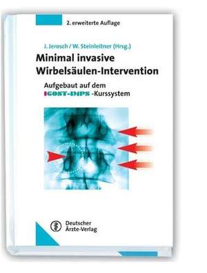 Minimal invasive Wirbelsäulen-Intervention de M. Ahrens