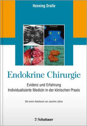 Endokrine Chirurgie de Henning Dralle