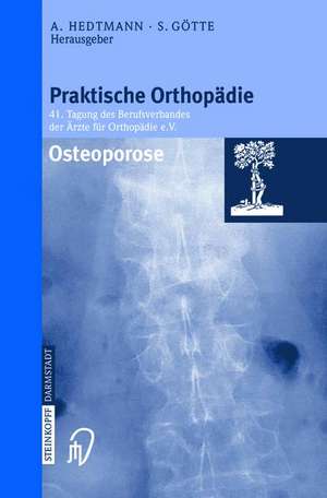 Osteoporose de Achim Hedtmann