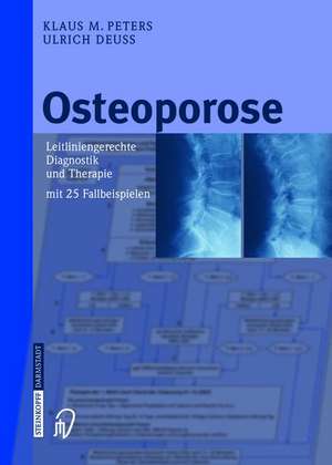 Osteoporose: Leitliniengerechte Diagnostik und Therapie mit 25 Fallbeispielen de Klaus M. Peters