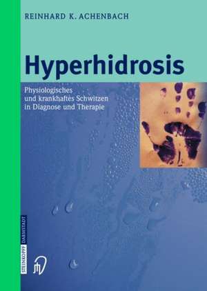 Hyperhidrosis